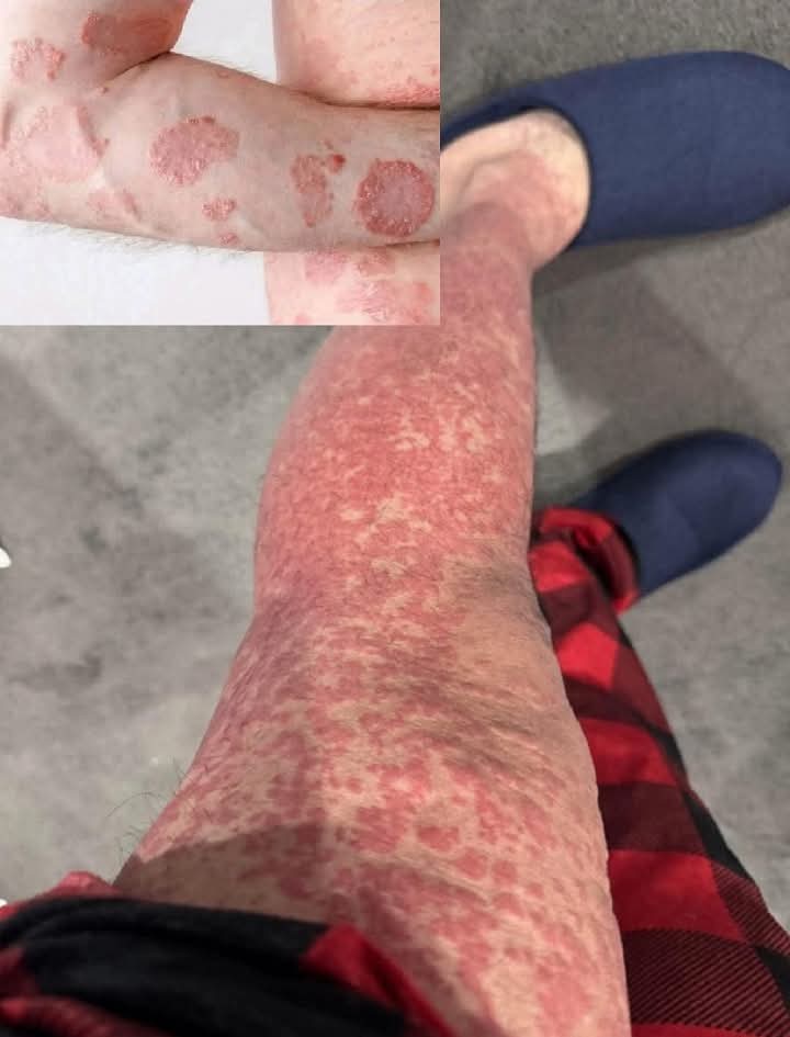 These are the consequences of sleeping with…See more